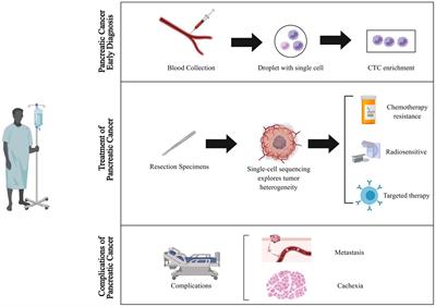 Advancement of single-cell sequencing for clinical diagnosis and treatment of pancreatic cancer